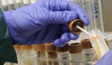 Die Notwendigkeit, die Analyse von Parasiten zu bestehen