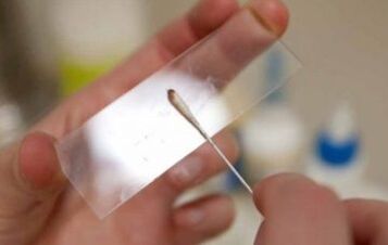 Welche Tests sollten für Parasiten durchgeführt werden