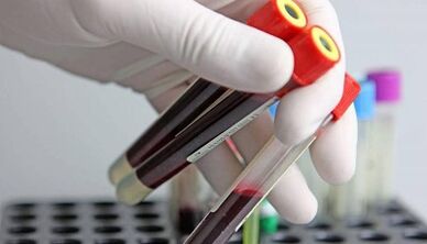 wie man Tests für Parasiten im Körper durchnimmt