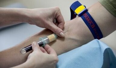 wie man sich auf den Test von Parasiten vorbereitet