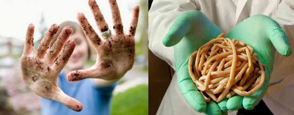 Durch schmutzige Hände können Parasiten in den Körper gelangen
