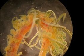 nematöse Parasiten im menschlichen Körper